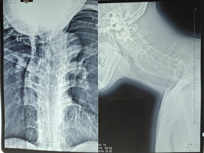 2020101212472167